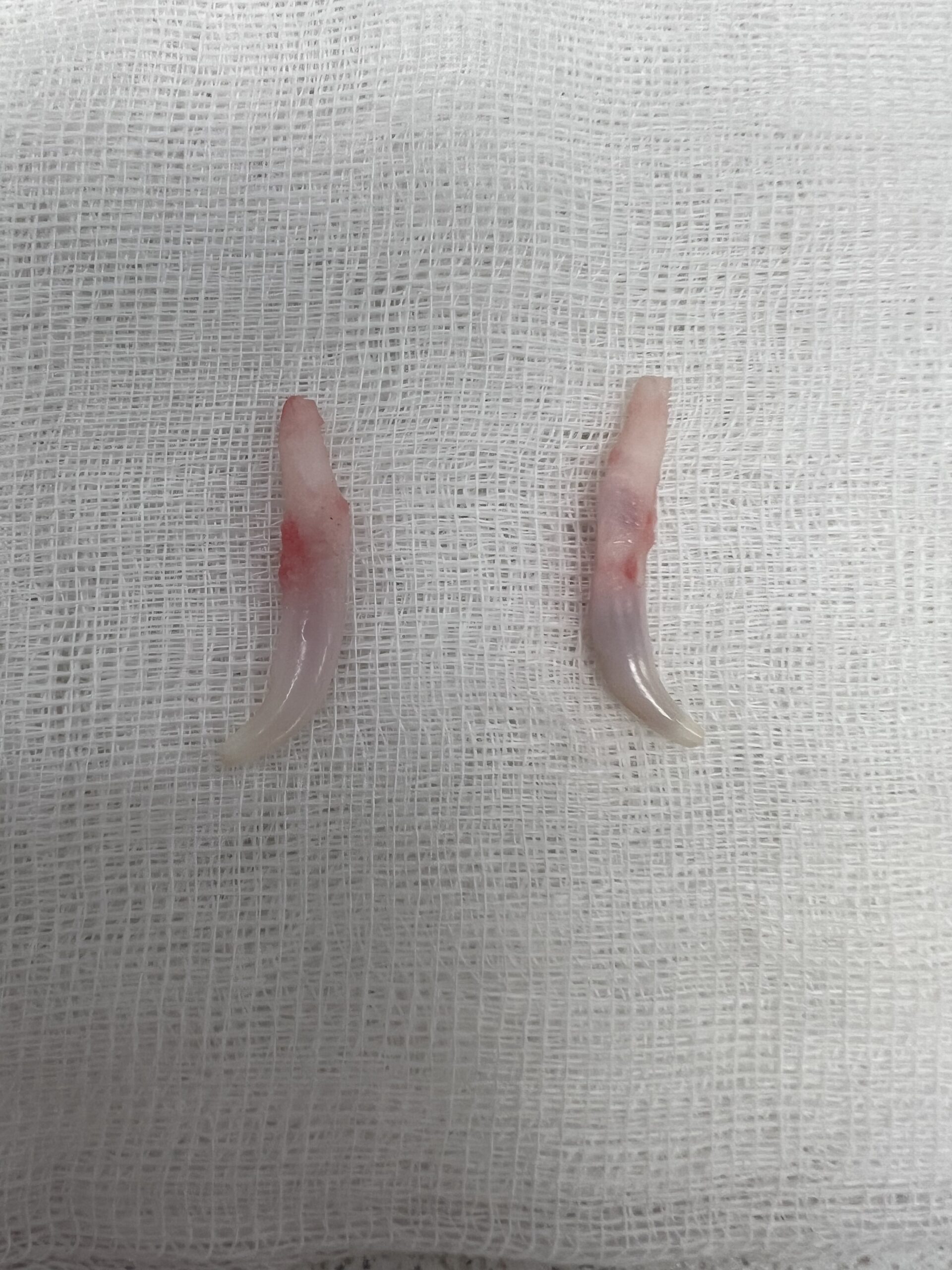 Retente hjørnetenner som er trekt ut