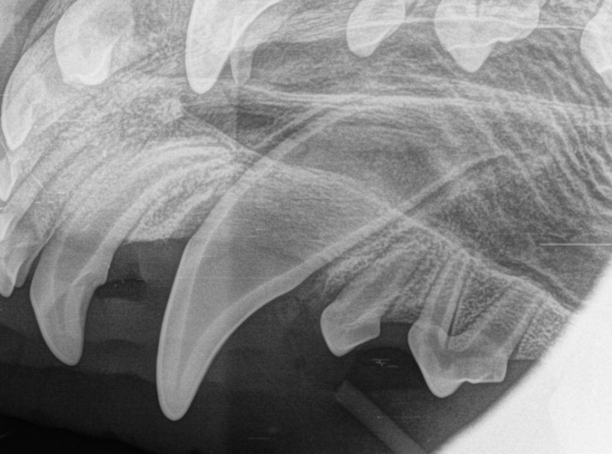 tannrøntgen, Retente hjørnetenner